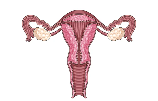 Endometriosis Treatment