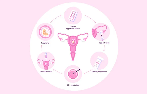 Intrauterine Insemination